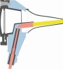 Otoskop mit direkter Beleuchtung