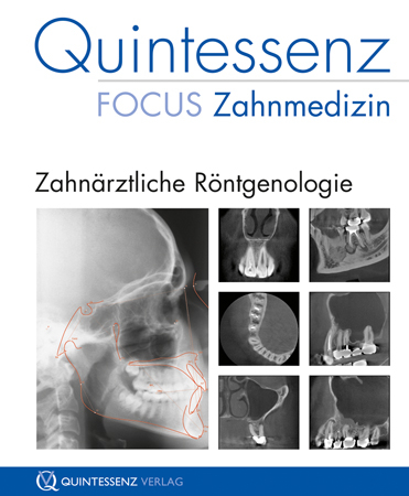 Quintessenz Focus Zahnmedizin: Zahnärztliche Röntgenologie - 