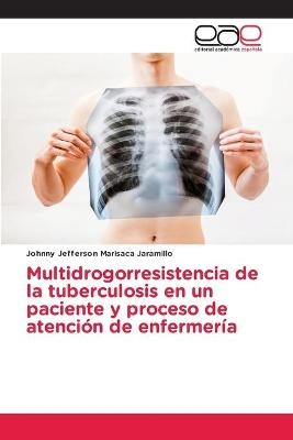 Multidrogorresistencia de la tuberculosis en un paciente y proceso de atención de enfermería - Johnny Jefferson Marisaca Jaramillo