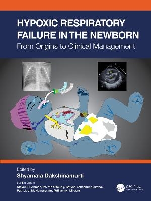 Hypoxic Respiratory Failure in the Newborn - 