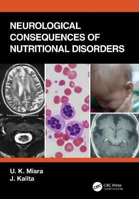 Neurological Consequences of Nutritional Disorders - U. K. Misra, J. Kalita