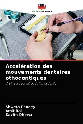 Accélération des mouvements dentaires othodontiques - Shweta Pandey, Amit Rai, Kavita Dhinsa