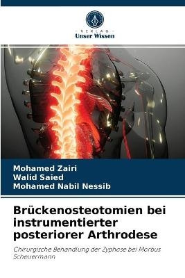 Brückenosteotomien bei instrumentierter posteriorer Arthrodese - Mohamed Zairi, Walid Saied, Mohamed Nabil Nessib