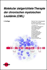 Molekular zielgerichtete Therapie der chronischen myeloischen Leukämie (CML) - Brümmendorf, Tim H.; Crysandt, Martina; Koschmieder, Steffen