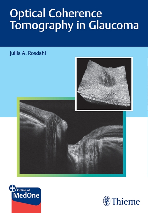 Optical Coherence Tomography in Glaucoma - Jullia Rosdahl