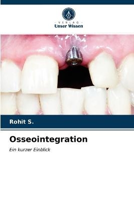 Osseointegration - Rohit S