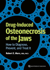 Drug-Induced Osteonecrosis of the Jaws - Robert E Marx