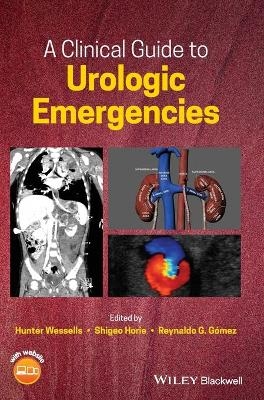 A Clinical Guide to Urologic Emergencies - 