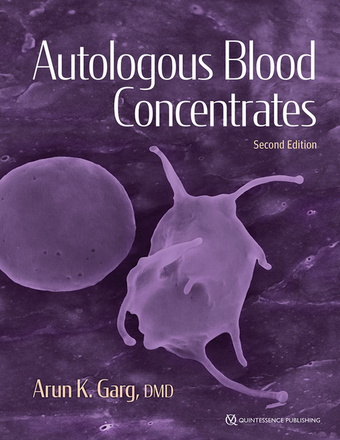 Autologous Blood Concentrates - Arun K Garg