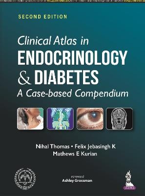 Clinical Atlas in Endocrinology and Diabetes - Nihal Thomas, Felix Jebasingh K, Mathews E Kurian