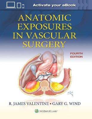 Anatomic Exposures in Vascular Surgery - R. James Valentine, Gary G. Wind