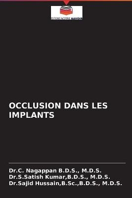 Occlusion Dans Les Implants - M D S Dr C Nagappan B D S, B D S M D S Kumar, B Sc B D S Hussain