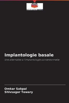 Implantologie basale - Omkar Sakpal, Shivsagar Tewary