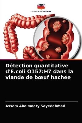 Détection quantitative d'E.coli O157 - Assem Abolmaaty Sayedahmed