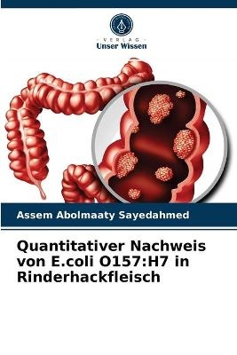 Quantitativer Nachweis von E.coli O157 - Assem Abolmaaty Sayedahmed