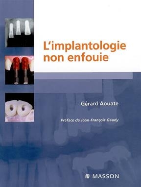 L'implantologie non enfouie - Gérard Aouate