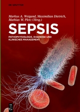 Sepsis - 