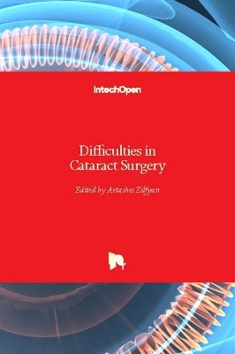 Difficulties in Cataract Surgery - 