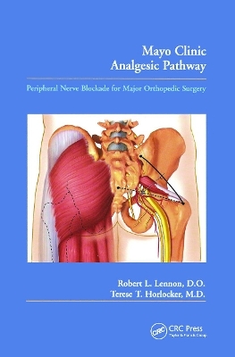 Mayo Clinic Analgesic Pathway - Robert L. Lennon, Terese T. Horlocker