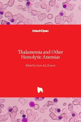 Thalassemia and Other Hemolytic Anemias - 