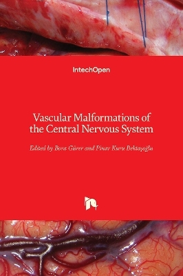 Vascular Malformations of the Central Nervous System - 