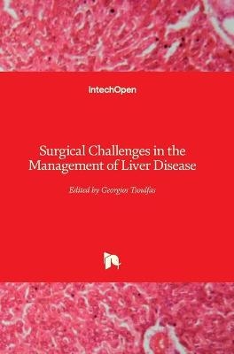 Surgical Challenges in the Management of Liver Disease - 