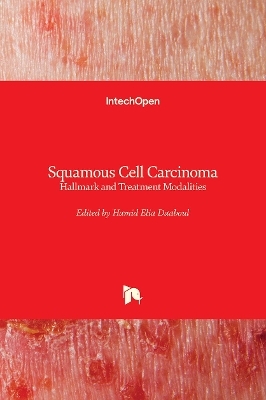 Squamous Cell Carcinoma - 