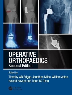 Operative Orthopaedics - 