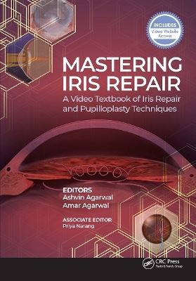 Mastering Iris Repair - Ashvin Agarwal, Amar Agarwal