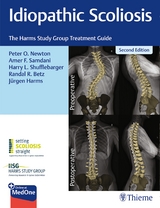 Idiopathic Scoliosis - Newton, Peter; Samdani, Amer; Shufflebarger, Harry; Betz, Randal; Harms, Jurgen