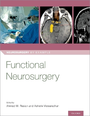 Functional Neurosurgery - 