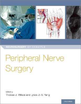 Peripheral Nerve Surgery - 