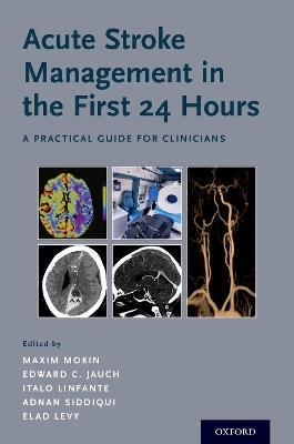 Acute Stroke Management in the First 24 Hours - 