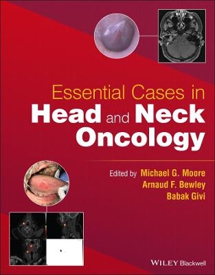 Essential Cases in Head and Neck Oncology - 