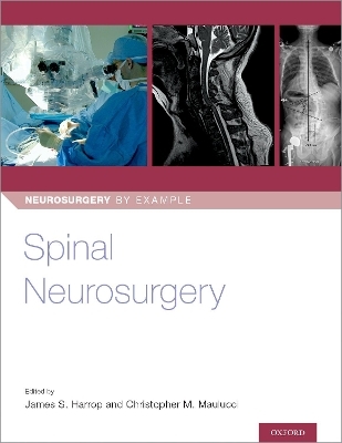 Spinal Neurosurgery - 