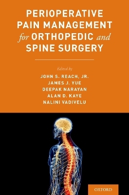 Perioperative Pain Management for Orthopedic and Spine Surgery - 