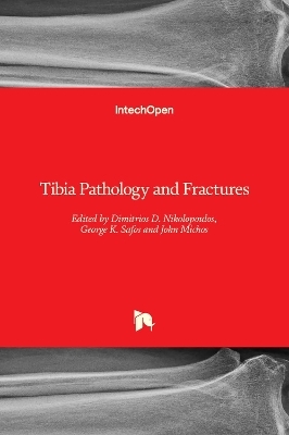 Tibia Pathology and Fractures - 