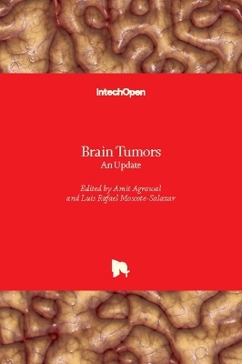 Brain Tumors - 