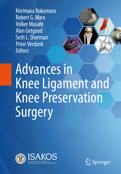 Advances in Knee Ligament and Knee Preservation Surgery - 