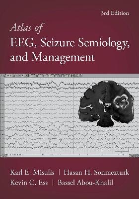 Atlas of EEG, Seizure Semiology, and Management - Bassel Abou-Khalil, Karl Edward Misulis, Hasan Sonmezturk, Kevin C. Ess