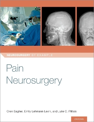 Pain Neurosurgery - 