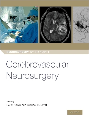Cerebrovascular Neurosurgery - 