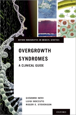 Overgrowth Syndromes - Giovanni Neri, Luigi Boccuto, Roger E. Stevenson
