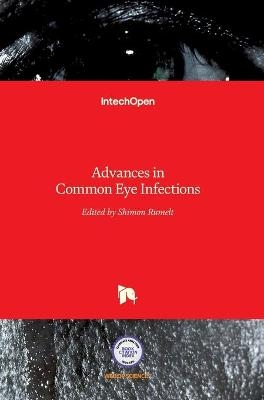 Advances in Common Eye Infections - 