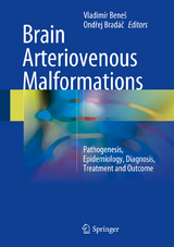 Brain Arteriovenous Malformations - 