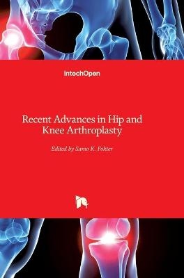 Recent Advances in Hip and Knee Arthroplasty - 