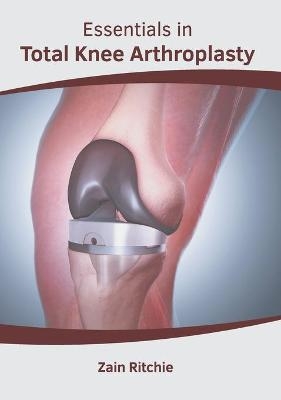 Essentials in Total Knee Arthroplasty - 