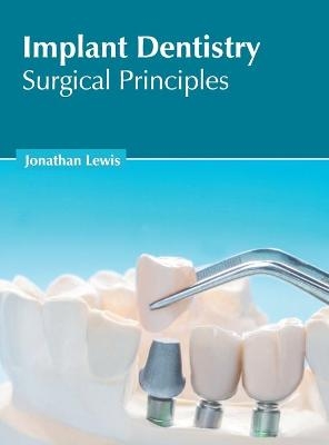 Implant Dentistry: Surgical Principles - 