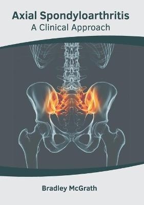 Axial Spondyloarthritis: A Clinical Approach - 