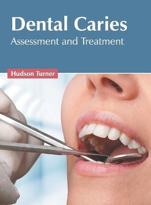 Dental Caries: Assessment and Treatment - 